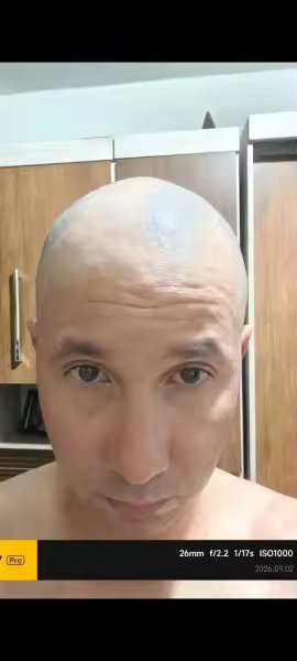 Resultado inicial de Miguel T.