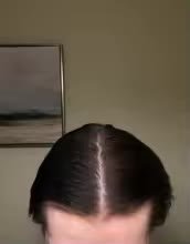 Proceso de Alonso P.