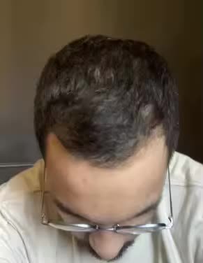 Proceso de Mario Torres