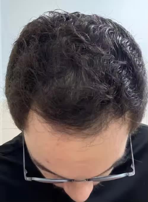 Después de Mario Torres